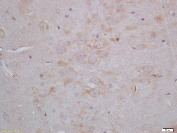 Formalin-fixed and paraffin embedded rat brain tissue labeled with Anti-Neurogranin Polyclonal Antibody, Unconjugated(bs-11435R) 1:200, followed by conjugation to the secondary antibody and DAB.