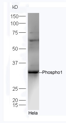Lane 1:Hela lysates probed with Rabbit Anti-Phospho1 Polyclonal Antibody, Unconjugated (bs-12562R) at 1:300 overnight at 4˚C. Followed by conjugation to secondary antibody (bs-0295G-HRP) at 1:5000 for 90 min at 37˚C. Lane 1:Hela lysates probed with Rabbit Anti-Phospho1 Polyclonal Antibody, Unconjugated (bs-12562R) at 1:300 overnight at 4˚C. Followed by conjugation to secondary antibody (bs-0295G-HRP) at 1:5000 for 90 min at 37˚C.
