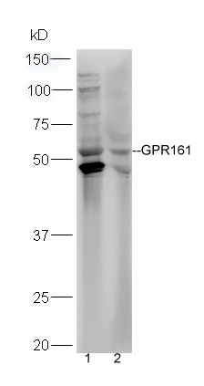 Lane 1: HepG2 lysates Lane 2: HL-60 lysates probed with Rabbit Anti-GPR161 Polyclonal Antibody, Unconjugated (bs-15385R) at 1:300 overnight at 4˚C. Followed by conjugation to secondary antibody (bs-0295G-HRP) at 1:5000 for 90 min at 37˚C.