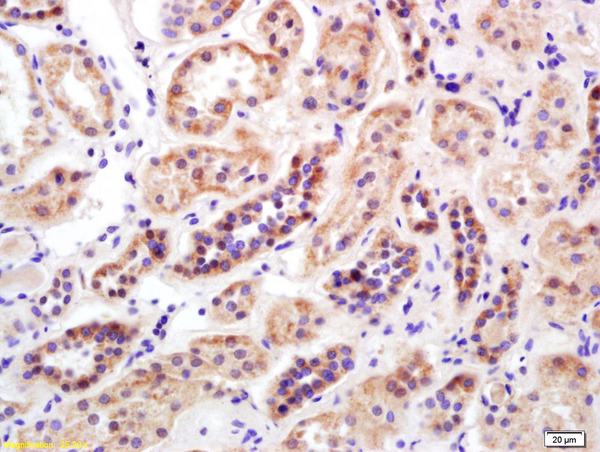 Formalin-fixed and paraffin embedded human kidney labeled with Rabbit Anti Mitofusin 2/MFN2 Polyclonal Antibody, Unconjugated (bs-2988R) at 1:200 followed by conjugation to the secondary antibody and DAB staining