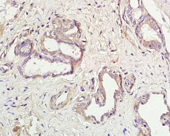 Formalin-fixed and paraffin embedded rat lung labeled with Rabbit Anti-AQP5 Polyclonal Antibody, Unconjugated (bs-1554R) at 1:200 followed by conjugation to the secondary antibody and DAB staining\n