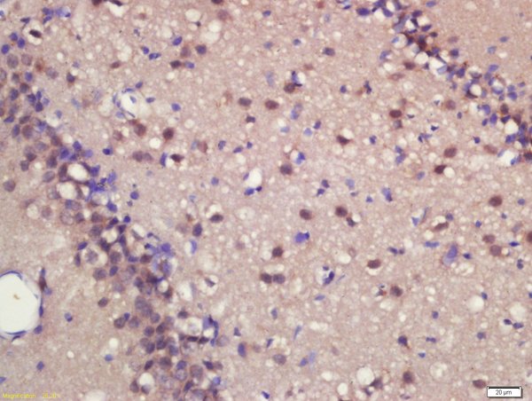 Formalin-fixed and paraffin embedded rat brain labeled with ASCL1 Polyclonal Antibody, Unconjugated (bs-1155R) at 1:200 followed by conjugation to the secondary antibody and DAB staining