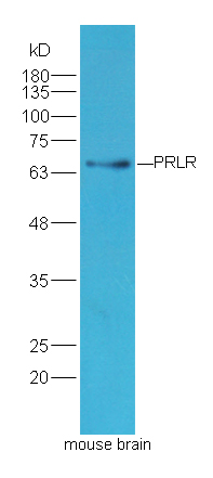 Lane 1: mouse brain lysates probed with Rabbit Anti-PRLR Polyclonal Antibody, Unconjugated (bs-6445R) at 1:300 overnight at 4˚C. Followed by conjugation to secondary antibody (bs-0295G-HRP) at 1:5000 for 90 min at 37˚C.