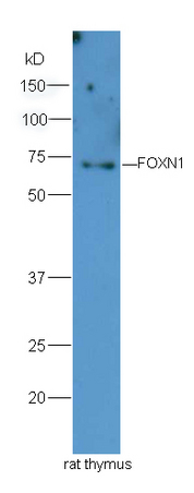 Lane 1:rat thymus lysates probed with Rabbit Anti-FOXN1 Polyclonal Antibody, Unconjugated (bs-6970R) at 1:300 overnight at 4˚C. Followed by conjugation to secondary antibody (bs-0295G-HRP) at 1:5000 for 90 min at 37˚C.