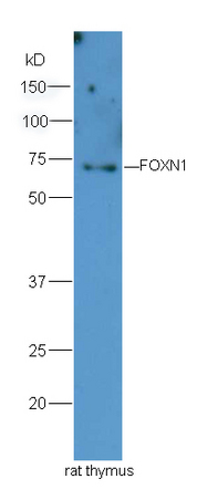 Lane 1:rat thymus lysates probed with Rabbit Anti-FOXN1 Polyclonal Antibody, Unconjugated (bs-6970R) at 1:300 overnight at 4˚C. Followed by conjugation to secondary antibody (bs-0295G-HRP) at 1:5000 for 90 min at 37˚C. Lane 1:rat thymus lysates probed with Rabbit Anti-FOXN1 Polyclonal Antibody, Unconjugated (bs-6970R) at 1:300 overnight at 4˚C. Followed by conjugation to secondary antibody (bs-0295G-HRP) at 1:5000 for 90 min at 37˚C.