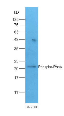 Lane 1: rat brain lysates probed with Rabbit Anti-RhoA(Ser188) Polyclonal Antibody, Unconjugated (bs-5330R) at 1:300 overnight at 4˚C. Followed by conjugation to secondary antibody (bs-0295G-HRP) at 1:5000 for 90 min at 37˚C.