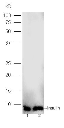 Lane 1: human islet alpha lysates Lane 2: human islet beta lysates probed with Rabbit Anti-Insulin Polyclonal Antibody, Unconjugated (bs-0862R) at 1:300 overnight at 4˚C. Followed by conjugation to secondary antibody (bs-0295G-HRP) at 1:5000 for 90 min at 37˚C.