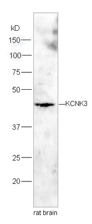 Lane 1:Rat brain lysates probed with Rabbit Anti-KCNK3 Polyclonal Antibody, Unconjugated (bs-2963R) at 1:200 overnight at 4˚C. Followed by conjugation to secondary antibody (bs-0295G-HRP) at 1:3000 for 90 min at 37˚C.