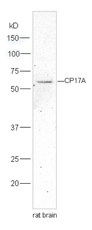 Lane 1:rat brain lysates probed with Rabbit Anti-Cytochrome P450 17A1 Polyclonal Antibody, Unconjugated (bs-6695R) at 1:300 overnight at 4˚C. Followed by conjugation to secondary antibody (bs-0295G-HRP) at 1:5000 for 90 min at 37˚C.