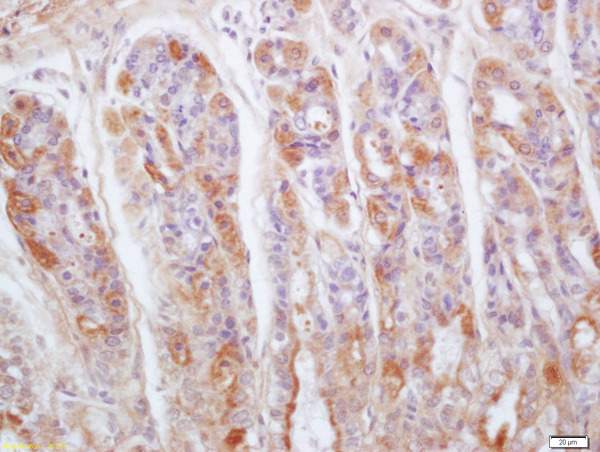 Formalin-fixed and paraffin embedded mouse stomach tissue labeled with Rabbit Anti-Gastrokine 1 Polyclonal Antibody, Unconjugated (bs-14441R) at 1:200 followed by conjugation to the secondary antibody and DAB staining.