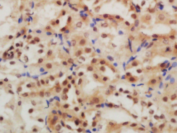 Formalin-fixed and paraffin embedded rat kidney labeled with Rabbit Anti-GLIS3 Polyclonal Antibody, Unconjugated (bs-16249R) at 1:200 followed by conjugation to the secondary antibody and DAB staining