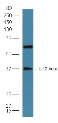 Mouse spleen lysates probed with Rabbit Anti-IL-12 beta Polyclonal Antibody, Unconjugated (bs-10641R) at 1:300 overnight at 4˚C. Followed by conjugation to secondary antibody (bs-0295G-HRP) at 1:5000 for 90 min at 37˚C.