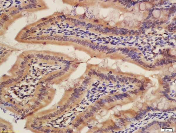 Formalin-fixed and paraffin embedded rat colon labeled with Rabbit Rabbit Anti-CISD1 Polyclonal Antibody, Unconjugated (bs-13959R) at 1:200 followed by conjugation to the secondary antibody and DAB staining