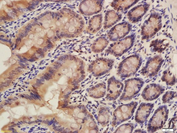 Formalin-fixed and paraffin embedded rat colon labeled with Rabbit Rabbit Anti-CISD1 Polyclonal Antibody, Unconjugated (bs-13959R) at 1:200 followed by conjugation to the secondary antibody and DAB staining