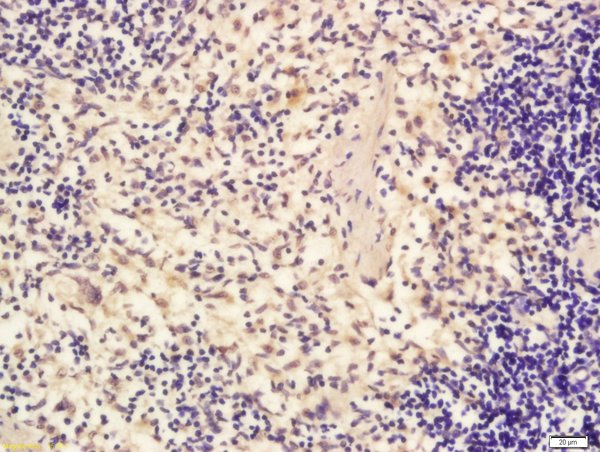 Formalin-fixed and paraffin embedded human spleen labeled with Rabbit Anti-eIF4ENIF1 Polyclonal Antibody, Unconjugated (bs-14561R) at 1:200 followed by conjugation to the secondary antibody and DAB staining