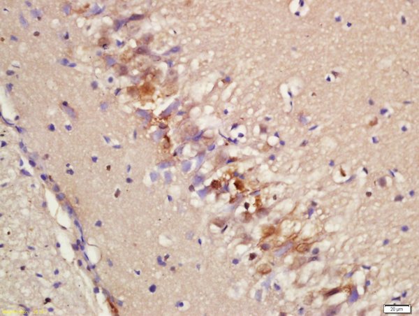 Formalin-fixed and paraffin embedded rat brain labeled with Rabbit Anti-Epac2 Polyclonal Antibody, Unconjugated (bs-10955R) at 1:200 followed by conjugation to the secondary antibody and DAB staining