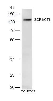 Mouse testis lysates probed with Rabbit Anti-SCP1 Polyclonal Antibody, Unconjugated (bs-17297R) at 1:300 overnight at 4˚C. Followed by conjugation to secondary antibody (bs-0295G-HRP) at 1:5000 for 90 min at 37˚C.