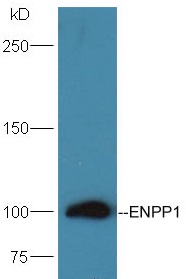 Mouse Kidney lysates probed with Rabbit Anti-ENPP1 Polyclonal Antibody, Unconjugated (bs-1760R) at 1:300 overnight at 4˚C. Incubate with HRP conjugated Goat-Anti-Rabbit IgG (bs-0295G-HRP) at 1: 5000 for 90min at 37˚C.
