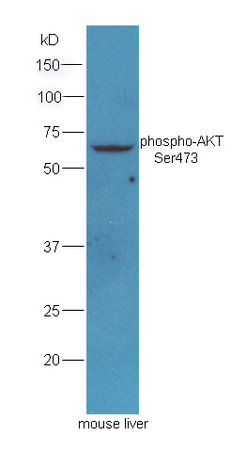 Mouse liver lysates probed with Rabbit Anti-AKT(Ser473) Polyclonal Antibody, Unconjugated (bs-0876) at 1:300 overnight at 4˚C. Incubate with HRP conjugated Goat-Anti-Rabbit IgG (bs-0295G-HRP) at 1: 5000 for 90min at 37˚C.
