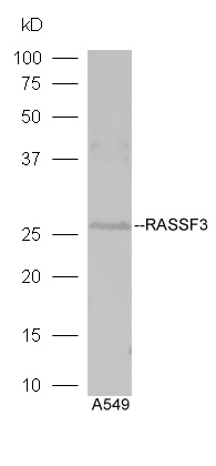 Lane 1:A549 lysates probed with Rabbit Anti-RASSF3 Polyclonal Antibody, Unconjugated (bs-6078R) at 1:300 overnight at 4˚C. Followed by conjugation to secondary antibody (bs-0295G-HRP) at 1:5000 for 90 min at 37˚C. Lane 1:A549 lysates probed with Rabbit Anti-RASSF3 Polyclonal Antibody, Unconjugated (bs-6078R) at 1:300 overnight at 4˚C. Followed by conjugation to secondary antibody (bs-0295G-HRP) at 1:5000 for 90 min at 37˚C.