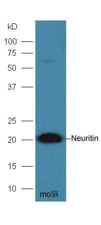 Mouse brain lysates probed with Anti- Neuritin Polyclonal Antibody, Unconjugated (bs-2464R) at 1:300 overnight at 4˚C. Followed by conjugation to secondary antibody (bs-0295G-HRP) at 1:5000 for 90 min at 37˚C.