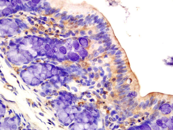 Formalin-fixed and paraffin embedded rat colon tissue labeled with Anti-AMPK alpha-1 Polyclonal Antibody, Unconjugated (bs-10344R) at 1:200 followed by conjugation to the secondary antibody and DAB staining