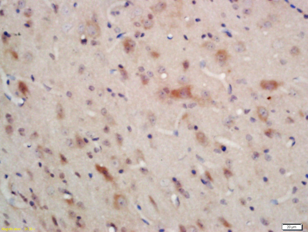Formalin-fixed and paraffin embedded rat brain labeled with Anti-AMPK alpha-1 Polyclonal Antibody, Unconjugated (bs-10344R) at 1:200 followed by conjugation to the secondary antibody and DAB staining