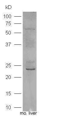 Mouse liver lysates probed with Rabbit Anti-IGF-1 Polyclonal Antibody, Unconjugated (bs-0014R) at 1:300 overnight at 4˚C. Followed by a conjugated secondary antibody (bs-0295G-HRP) at 1:3000 for 90 min at 37˚C.