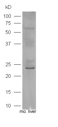 Mouse liver lysates probed with Rabbit Anti-IGF-1 Polyclonal Antibody, Unconjugated (bs-0014R) at 1:300 overnight at 4°C. Followed by a conjugated secondary antibody (bs-0295G-HRP) at 1:3000 for 90 min at 37°C.