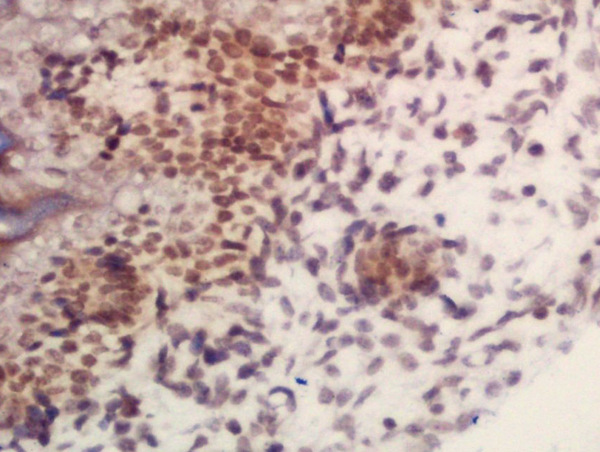 Formalin-fixed and paraffin embedded mouse embryo labeled with Rabbit Anti-ARID1B Polyclonal Antibody, Unconjugated (bs-12520R) at 1:200 followed by conjugation to the secondary antibody and DAB staining\n