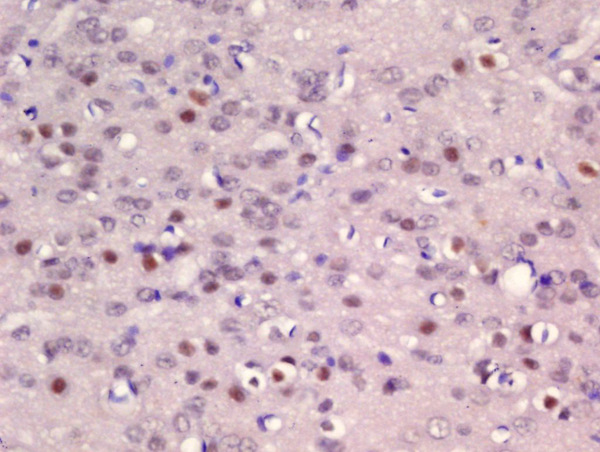 Formalin-fixed and paraffin embedded rat brain labeled with Rabbit Anti-ER81 Polyclonal Antibody, Unconjugated (bs-11745R) at 1:200 followed by conjugation to the secondary antibody and DAB staining\n