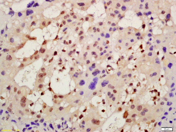 Formalin-fixed and paraffin embedded mouse placenta labeled with Rabbit Anti-AMIGO2 Polyclonal Antibody, Unconjugated (bs-11450R) at 1:200 followed by conjugation to the secondary antibody and DAB staining Formalin-fixed and paraffin embedded mouse placenta labeled with Rabbit Anti-AMIGO2 Polyclonal Antibody, Unconjugated (bs-11450R) at 1:200 followed by conjugation to the secondary antibody and DAB staining