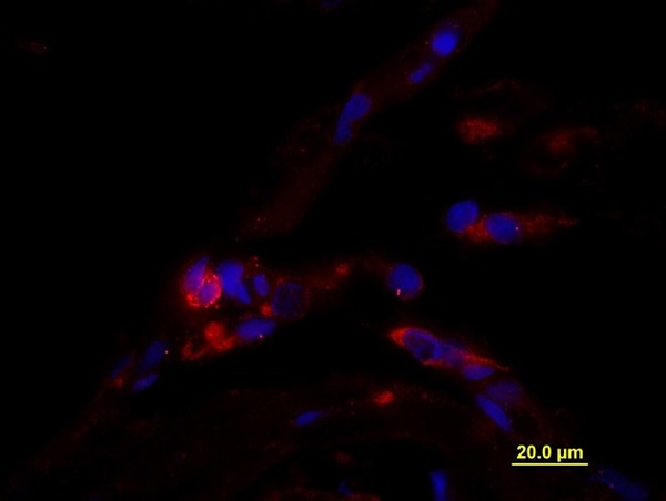 Formalin-fixed and paraffin embedded Human testis tissue labeled with unconjugated Anti-CD163/M130 Polyclonal Antibody, unconjugated (bs-2527R) at 1:100 for 40 minutes at 37°C followed by labeling Donkey Anti-Rabbit, Cy3 conjugated 1:300, 60 minutes at 37°C. DAPI nuclear stain employed. Image shows membrane staining of testicular macrophages in the interstitial compartment of the testis, while cells in the seminiferous tubules are negative. \n