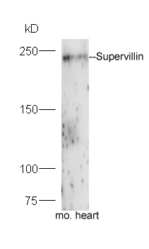 Mouse heart lysates probed with Rabbit Anti-Supervillin Polyclonal Antibody, Unconjugated (bs-7123R) at 1:300 overnight at 4˚C. Followed by a conjugated secondary antibody (bs-0295G-HRP) at 1:5000 for 90 min at 37˚C.