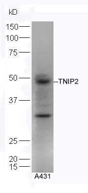 Human A431 lysates probed with Rabbit Anti-TNIP2 Polyclonal Antibody, Unconjugated (bs-7563R) at 1:300 overnight at 4˚C. Followed by a conjugated secondary antibody (bs-0295G-HRP) at 1:5000 for 90 min at 37˚C. Human A431 lysates probed with Rabbit Anti-TNIP2 Polyclonal Antibody, Unconjugated (bs-7563R) at 1:300 overnight at 4˚C. Followed by a conjugated secondary antibody (bs-0295G-HRP) at 1:5000 for 90 min at 37˚C.