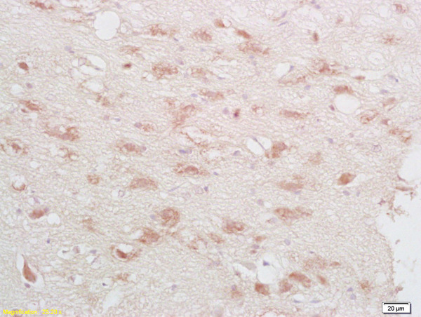 Formalin-fixed and paraffin embedded rat brain labeled with Rabbit Anti-phospho-CREB-1(Ser133) Polyclonal Antibody, Unconjugated 1:500 followed by conjugation to the secondary antibody