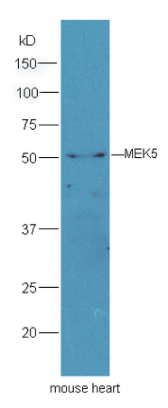 Mouse heart lysates probed with Rabbit Anti-MEK5 Antibody, Unconjugated (bs-4124R) at 1:300 overnight at 4˚C. Followed by a conjugated secondary antibody (bs-0295G-HRP) at 1:5000 for 90 min at 37˚C.