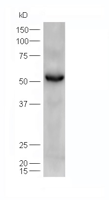 Lane 1: mouse heart probed with Rabbit Anti-ATGL/Adipose Triglyceride Lipase Polyclonal Antibody, Unconjugated (bs-3831R) at 1:300 overnight at 4˚C. Followed by conjugation to secondary antibody (bs-0295G-HRP) at 1:5000 for 90 min at 37˚C.