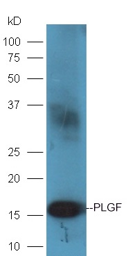 Rat placenta lysates probed with Rabbit Anti-PLGF Polyclonal Antibody, Unconjugated (bs-0280R) at 1:300 overnight at 4˚C. Followed by a conjugated secondary antibody (bs-0295G-HRP) at 1:5000 for 90 min at 37˚C.