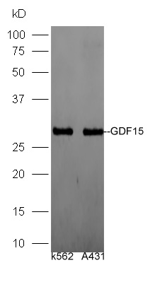 Lane 1: Human K562 lysates, Lane 2: Human A431 lysates probed with Rabbit Anti-GDF15/MIC-1 Polyclonal Antibody, Unconjugated (bs-3818R) at 1:300 overnight at 4˚C. Followed by a conjugated secondary antibody (bs-0295G-HRP) at 1:5000 for 90 min at 37˚C.