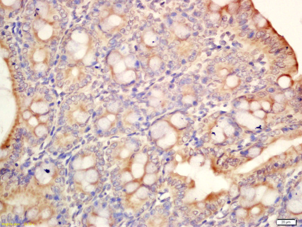 Formalin-fixed and paraffin embedded mouse intestine labeled with Rabbit Anti-MAdCAM1 Polyclonal Antibody, Unconjugated (bs-11179R) at 1:200 followed by conjugation to the secondary antibody and DAB staining\n