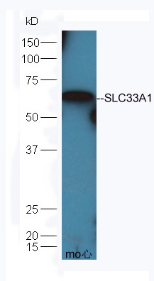 Mouse heart lysate probed (bs-0699R) at 1:300 overnight in 4˚C. Followed by conjugation to the secondary antibody (bs-0295G-HRP) at 1:5000 90min in 37˚C. Mouse heart lysate probed (bs-0699R) at 1:300 overnight in 4˚C. Followed by conjugation to the secondary antibody (bs-0295G-HRP) at 1:5000 90min in 37˚C.
