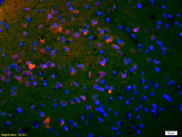 Formalin-fixed and paraffin-embedded rat brain labeled with Anti-phospho-CREB-1(Ser133) Polyclonal Antibody, Unconjugated(bs-0036R) 1:200, overnight at 4\u00b0C, The secondary antibody was Goat Anti-Rabbit IgG, Cy3 conjugated(bs-0295G-Cy3)used at 1:200 dilution for 40 minutes at 37\u00b0C.