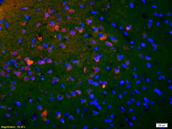 Formalin-fixed and paraffin-embedded rat brain labeled with Anti-phospho-CREB-1(Ser133) Polyclonal Antibody, Unconjugated(bs-0036R) 1:200, overnight at 4°C, The secondary antibody was Goat Anti-Rabbit IgG, Cy3 conjugated(bs-0295G-Cy3)used at 1:200 dilution for 40 minutes at 37°C.