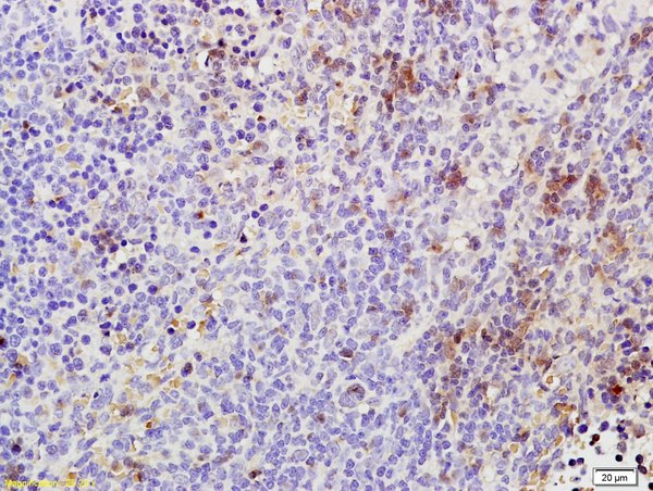 Formalin-fixed and paraffin embedded rat spleen labeled with Rabbit Anti Phospho-TAK1(Thr184/187) Polyclonal Antibody, Unconjugated (bs-3439R) at 1:200 followed by conjugation to the secondary antibody and DAB staining