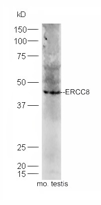 Mouse testis lysates probed with Rabbit Anti-ERCC*/CSA Polyclonal Antibody, Unconjugated (bs-13095R) at 1:300 overnight at 4˚C. Followed by a conjugated secondary antibody (bs-0295G-HRP) at 1:5000 for 90 min at 37˚C.