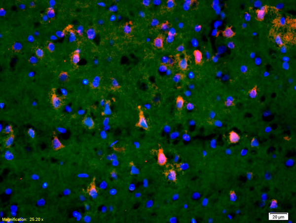 Formalin-fixed and paraffin-embedded rat brain labeled with Anti-Phospho-TAK1(Thr184/187) Polyclonal Antibody, Unconjugated(bs-3439R) 1:200, overnight at 4°C, The secondary antibody was Goat Anti-Rabbit IgG, Cy3 conjugated(bs-0295G-Cy3)used at 1:200 dilution for 40 minutes at 37°C.