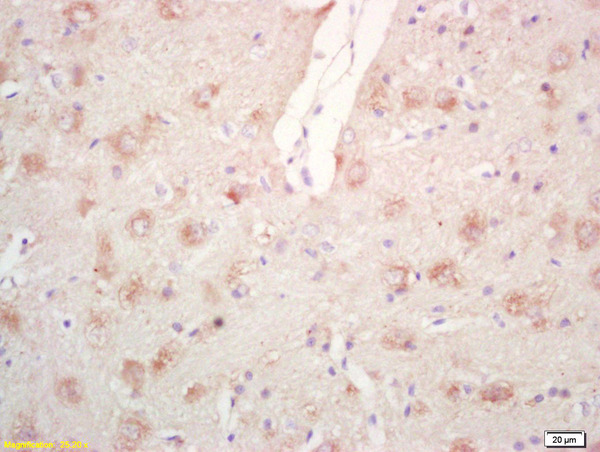 Formalin-fixed and paraffin embedded rat brain labeled with Rabbit Anti Phospho-PPIG (Ser376) Polyclonal Antibody, Unconjugated (bs-3461R) at 1:200 followed by conjugation to the secondary antibody and DAB staining