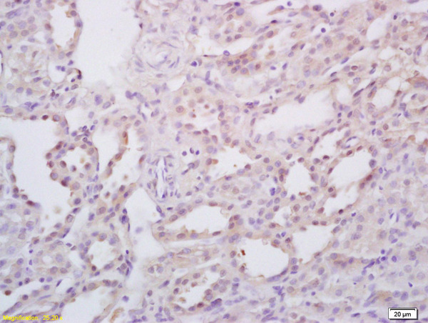 Formalin-fixed and paraffin embedded rat kidney labeled with Rabbit Anti StAR/StARD1 Polyclonal Antibody, Unconjugated (bs-3570R) at 1:200 followed by conjugation to the secondary antibody and DAB staining