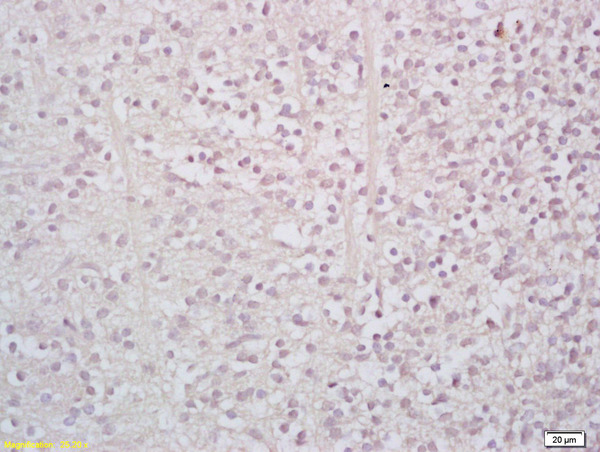 Formalin-fixed and paraffin embedded mouse embryo labeled with Rabbit Anti StAR/StARD1 Polyclonal Antibody, Unconjugated (bs-3570R) at 1:200 followed by conjugation to the secondary antibody and DAB staining